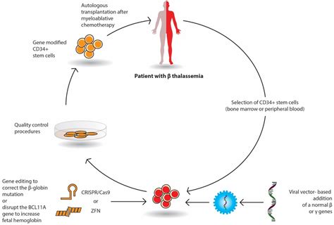 beta thalassemia major|Advanced transplant in 2.